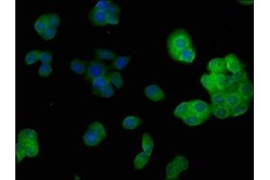 Immunofluorescence staining of PC-3 cells with ABIN7139700 at 1:50, counter-stained with DAPI.