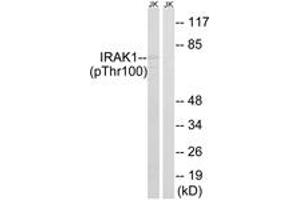 Western blot analysis of extracts from Jurkat cells treated with heat shock, using IRAK1 (Phospho-Thr100) Antibody. (IRAK1 anticorps  (pThr100))