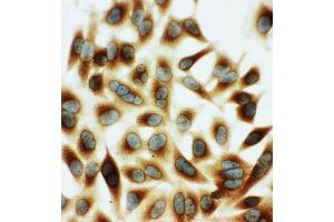 Anti-HSPB2 antibody, ICC ICC: HELA Cell