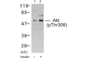 Western blot analysis using Akt (Phospho-Thr308) Antibody. (AKT1 anticorps  (pThr308))
