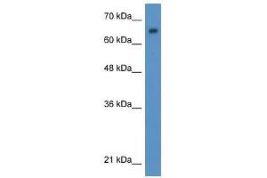 Western Blot showing WT1 antibody used at a concentration of 1-2 ug/ml to detect its target protein. (WT1 anticorps  (N-Term))