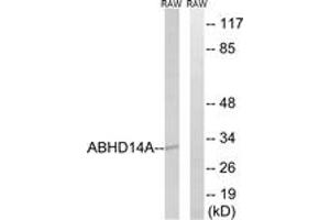 Western Blotting (WB) image for anti-Abhydrolase Domain Containing 14A (ABHD14A) (AA 201-250) antibody (ABIN2890082) (ABHD14A anticorps  (AA 201-250))