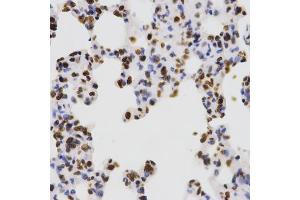 Immunohistochemistry of paraffin-embedded rat lung using Dimethyl-Histone H3-K4 antibody (ABIN5969803) at dilution of 1/200 (40x lens). (Histone 3 anticorps  (H3K4me2))
