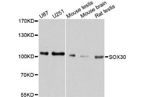 Western blot analysis of extracts of various cell lines, using SOX30 antibody. (SOX30 anticorps  (AA 604-753))