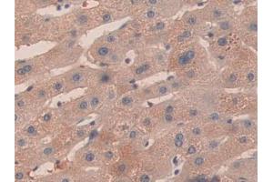 Used in DAB staining on fromalin fixed paraffin- embedded kidney tissue (KIR2DS2 anticorps  (AA 22-304))