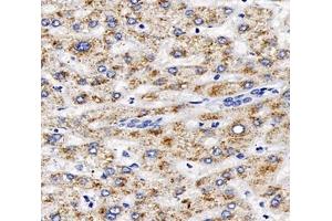 Immunohistochemistry analysis of paraffin-embedded human liver using,AGXT (ABIN7072987) at dilution of 1: 2000