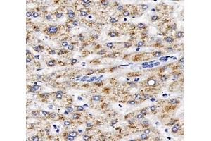 Immunohistochemistry analysis of paraffin-embedded human liver using,AGXT (ABIN7072987) at dilution of 1: 2000 (AGXT anticorps)