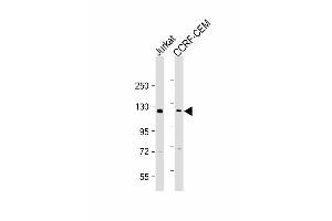 All lanes : Anti-GLI2 Antibody (C-term) at 1:2000 dilution Lane 1: Jurkat whole cell lysate Lane 2: CCRF-CEM whole cell lysate Lysates/proteins at 20 μg per lane. (GLI2 anticorps  (C-Term))