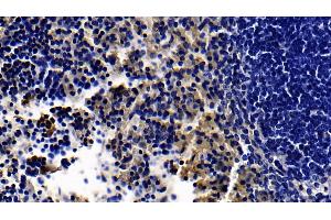 Detection of TLR5 in Mouse Spleen Tissue using Polyclonal Antibody to Toll Like Receptor 5 (TLR5) (TLR5 anticorps  (AA 693-858))