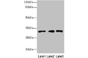 Western blot All lanes: PRDX4 antibody at 8 μg/mL Lane 1: HepG2 whole cell lysate Lane 2: Hela whole cell lysate Lane 3: 293T whole cell lysate Secondary Goat polyclonal to rabbit IgG at 1/10000 dilution Predicted band size: 31 kDa Observed band size: 31 kDa (Peroxiredoxin 4 anticorps  (AA 38-271))