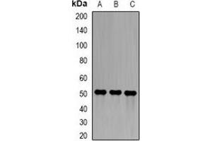 Western blot analysis of Epsilon-sarcoglycan expression in A549 (A), ES2 (B), mouse lung (C) whole cell lysates. (SGCE anticorps)