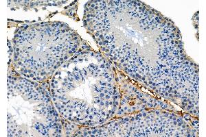 ABIN6258677 and ABIN6274898 at 1/100 staining Mouse testis tissue by IHC-P.
