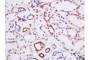 Formalin-fixed and paraffin embedded human kidney labeled with Anti-DTX3L Polyclonal Antibody, Unconjugated  at 1:200 followed by conjugation to the secondary antibody and DAB staining.