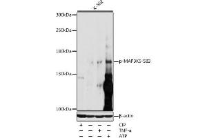Western blot analysis of extracts of various cell lines, using Phospho-MK5-S83 antibody (ABIN3019487, ABIN3019488, ABIN3019489 and ABIN6225424) at 1:1000 dilution. (ASK1 anticorps  (pSer83))