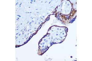 Immunohistochemistry of paraffin-embedded human placenta using RhoA Rabbit pAb (ABIN3020848, ABIN3020849, ABIN3020850 and ABIN6213755) at dilution of 1:100 (40x lens). (RHOA anticorps  (C-Term))