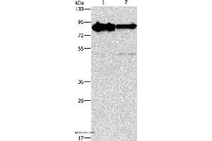 Western blot analysis of Mouse brain and human brain malignant glioma tissue, using KIF3A Polyclonal Antibody at dilution of 1:750 (KIF3A anticorps)