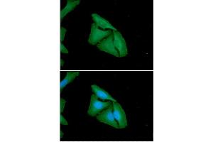 ICC/IF analysis of FHL2 in HeLa cells. (FHL2 anticorps)