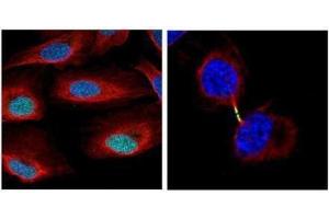 ICC/IF Image Confocal immunofluorescence analysis (Olympus FV10i) of paraformaldehyde-fixed U2OS, using Survivin, antibody (Geen) at 1:500 dilution. (Survivin anticorps)
