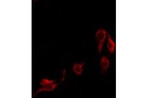 ABIN6275714 staining COLO205 by IF/ICC. (IGFALS anticorps  (Internal Region))