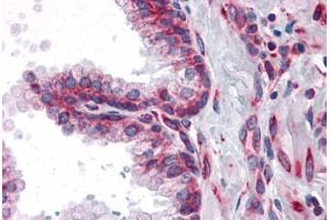 Human Prostate: Formalin-Fixed, Paraffin-Embedded (FFPE) (MTDH anticorps)