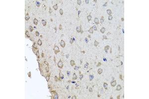 Immunohistochemistry of paraffin-embedded mouse brain using HBA2 antibody at dilution of 1:100 (x40 lens). (HBa2 anticorps)