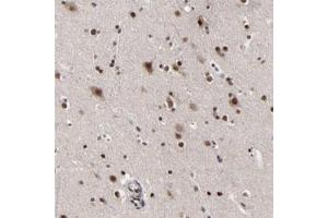 Immunohistochemical staining of human cerebral cortex with ZNF777 polyclonal antibody  shows strong nuclear positivity in neuronal and glial cells. (ZNF777 anticorps)