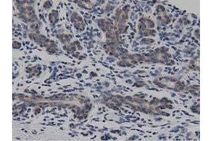 Immunohistochemistry (IHC) image for anti-DnaJ (Hsp40) Homolog, Subfamily A, Member 2 (DNAJA2) antibody (ABIN1497862)