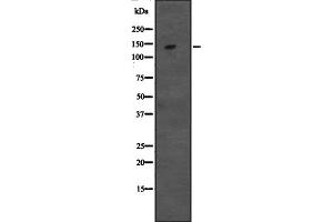 Western blot analysis of CCAR1 expression in Hela cell lysate,The lane on the left is treated with the antigen-specific peptide. (CCAR1 anticorps  (Internal Region))