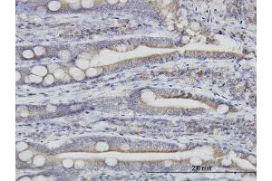 Immunoperoxidase of monoclonal antibody to TXNDC4 on formalin-fixed paraffin-embedded human small Intestine.
