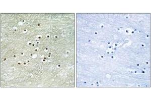 Immunohistochemistry analysis of paraffin-embedded human brain tissue, using NPAS4 Antibody. (NPAS4 anticorps  (AA 603-652))