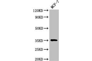Western Blot Positive WB detected in: MCF-7 whole cell lysate All lanes: ACY3 antibody at 3 μg/mL Secondary Goat polyclonal to rabbit IgG at 1/50000 dilution Predicted band size: 36 kDa Observed band size: 36 kDa (Aminoacylase 3 anticorps  (AA 5-319))