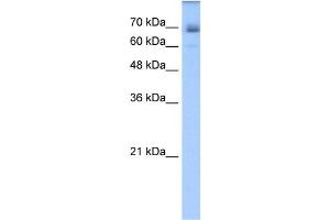 WB Suggested Anti-LNX1 Antibody Titration:  1. (LNX1 anticorps  (C-Term))