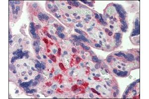 Human Placenta: Formalin-Fixed, Paraffin-Embedded (FFPE)