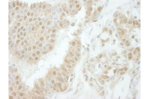 anti-TIP41-like protein (TIPRL) (C-Term) antibody