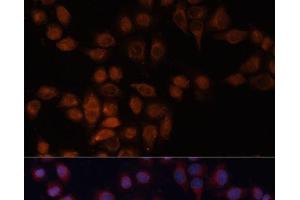 Immunofluorescence analysis of HeLa cells using ADAM15 Polyclonal Antibody at dilution of 1:100 (40x lens).
