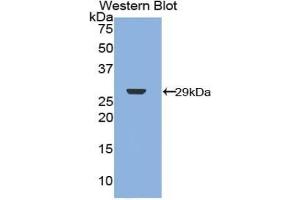 Detection of Recombinant NF2, Human using Polyclonal Antibody to Neurofibromin 2 (NF2) (Merlin anticorps  (AA 30-239))