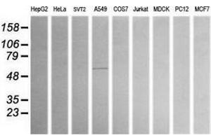 Western Blotting (WB) image for anti-Aldehyde Dehydrogenase 1 Family, Member A3 (ALDH1A3) (AA 1-100), (AA 413-512) antibody (ABIN2715887) (ALDH1A3 anticorps  (AA 1-100, AA 413-512))