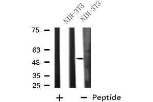Western blot analysis of extracts from NIH-3T3 cells, using DUSP10 antibody. (DUSP10 anticorps  (Internal Region))