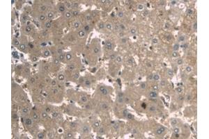 Detection of a1BG in Human Liver Tissue using Monoclonal Antibody to Alpha-1-B-Glycoprotein (a1BG)