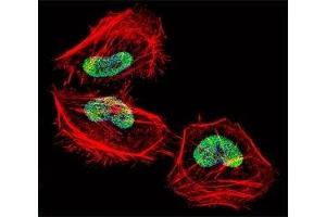 Fluorescent confocal image of HeLa cell stained with HDAC4 antibody at 1:25.