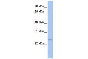 PRELID2 antibody used at 1 ug/ml to detect target protein. (PRELID2 anticorps  (C-Term))
