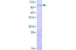 Image no. 1 for Procollagen-Lysine, 2-Oxoglutarate 5-Dioxygenase 3 (PLOD3) (AA 1-738) protein (GST tag) (ABIN1315453)