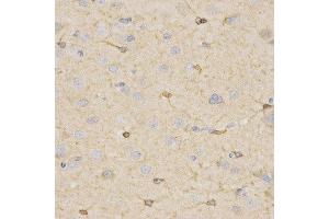 Immunohistochemistry (IHC) image for anti-Hydroxysteroid (17-Beta) Dehydrogenase 2 (HSD17B2) antibody (ABIN1873085) (HSD17B2 anticorps)