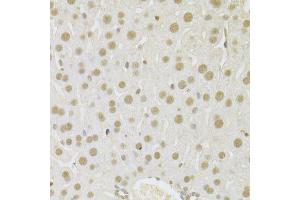 Immunohistochemistry of paraffin-embedded mouse liver using SFN Antibody. (14-3-3 sigma/SFN anticorps  (AA 1-248))