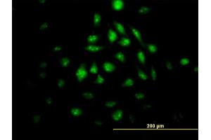 Immunofluorescence of monoclonal antibody to KLF10 on HeLa cell.