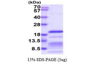 SDS-PAGE (SDS) image for Relaxin 2 (RLN2) (AA 25-185) protein (His tag) (ABIN6387989)