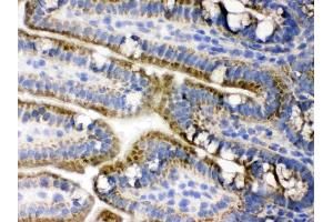 IHC analysis of PDPK1 using anti-PDPK1 antibody .