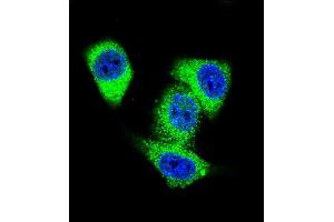 Confocal immunofluorescent analysis of TOP2A Antibody (C-term) (ABIN653195 and ABIN2842744) with Hela cell followed by Alexa Fluor 488-conjugated goat anti-rabbit lgG (green). (Topoisomerase II alpha anticorps  (C-Term))