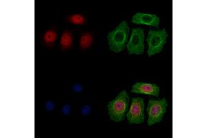 ABIN7094464 and ABIN7098512 staining HepG2 cells by IF/ICC. (Thymopoietin anticorps  (Internal Region))