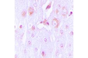 Immunohistochemical analysis of Tyrosine Hydroxylase staining in human brain formalin fixed paraffin embedded tissue section.